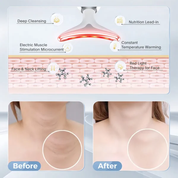 Masajeador Facial Reductor Arrugas